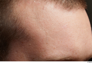 HD Face Skin Clifford Doyle face forehead skin pores skin…
